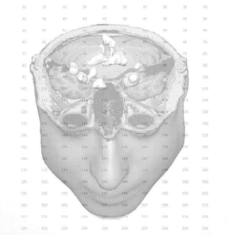Opening Itamar Gilboa World Of Plenty Fe 8331